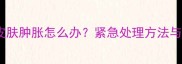 泰迪疫苗后皮肤肿胀怎么办紧急处理方法与注意事项全