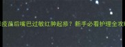 猫咪疫苗后嘴巴过敏红肿起疹新手必看护理全攻略