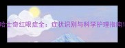 哈士奇红眼症全症状识别与科学护理指南