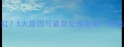 狗狗眼睛突然变红5大原因与紧急处理指南养宠必看的红眼病全