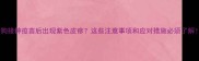狗狗接种疫苗后出现紫色皮疹这些注意事项和应对措施必须了解
