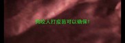 狗咬人打疫苗可以确保