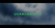 边牧真菌皮肤病为什么