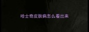 哈士奇皮肤病怎么看出来