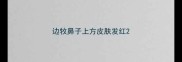 边牧鼻子上方皮肤发红